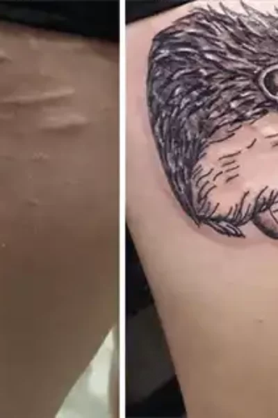 narben-tattoo-10-1