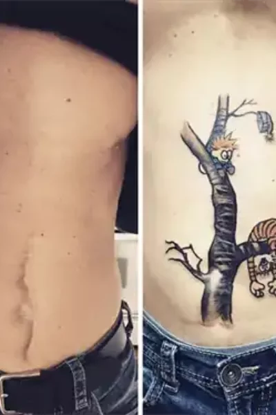 narben-tattoo-11-1
