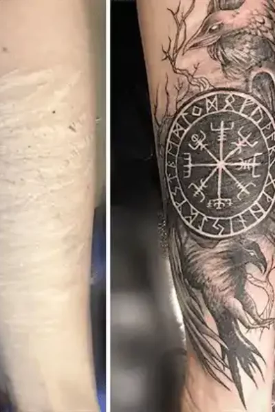 narben-tattoo-12-1