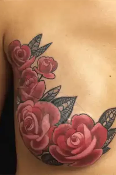 narben-tattoo-4