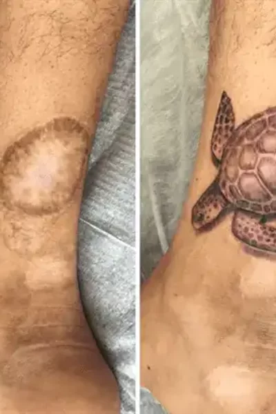 narben-tattoo-7
